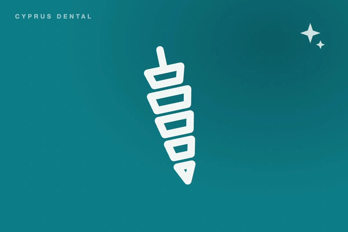 Cyprus Dental guide: All-on-4 in Cyprus: what full-jaw treatment really involves